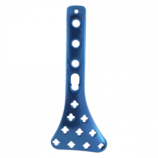 2, 7/3, 5 мм Блокированная VA дистальная задняя тибиальная пластина Москва - изображение 1