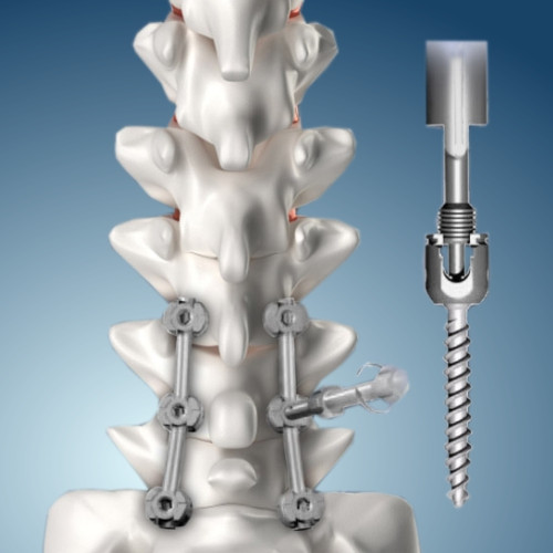 Хирургия позвоночника Москва - изображение 1