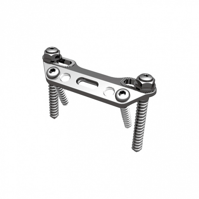 Тораколюмбарная пластина Москва - изображение 1