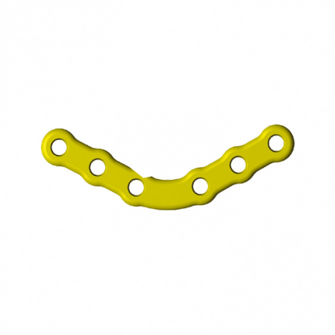 Угловая пластина (Реконструктивная) Москва - изображение 1