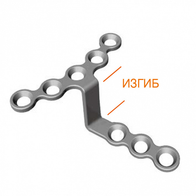 Предизогнутая ортогнатическая пластина Москва - изображение 1