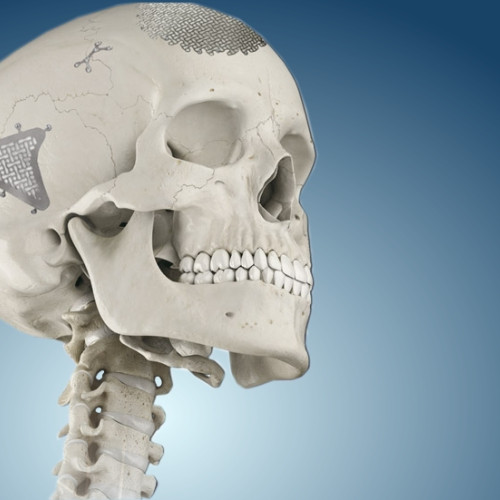 Краниопластика Москва - изображение 1