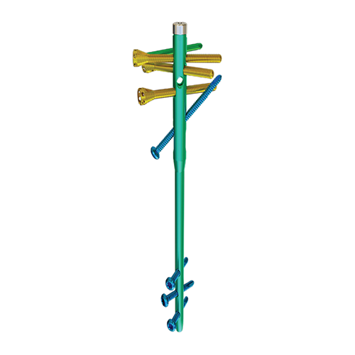 NAVIGATOR Плечевой интрамедуллярный штифт (длинная версия) Москва - изображение 1