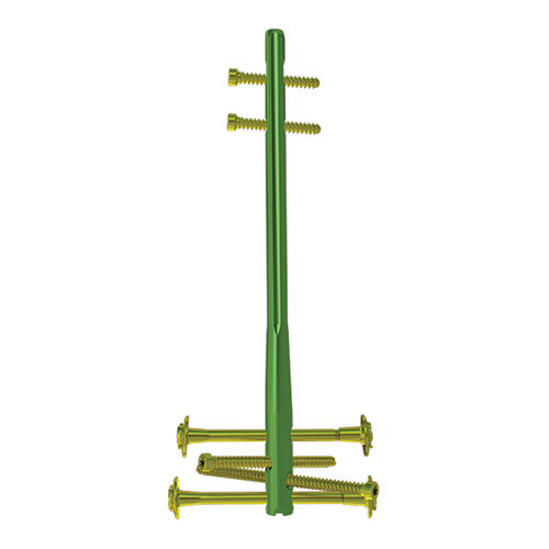 NAVIGATOR Ретроградный бедренный штифт Москва - изображение 1